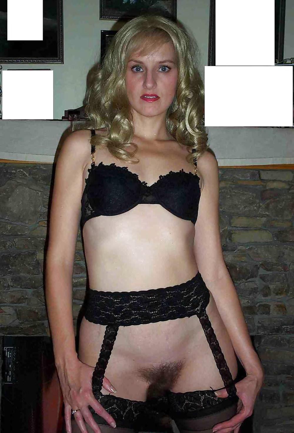 25P Public Hairy