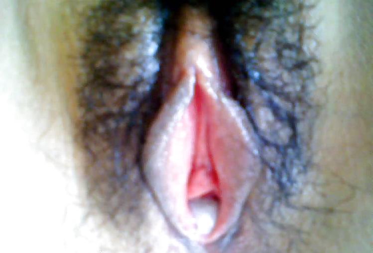 10P Chinese girl secretly fucked by gynecologist