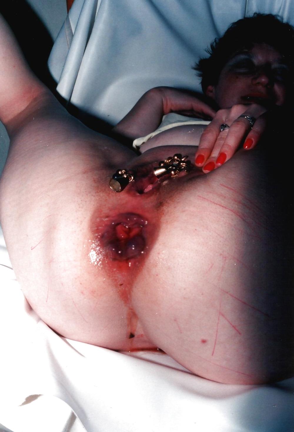 14P ANUS DESTROY