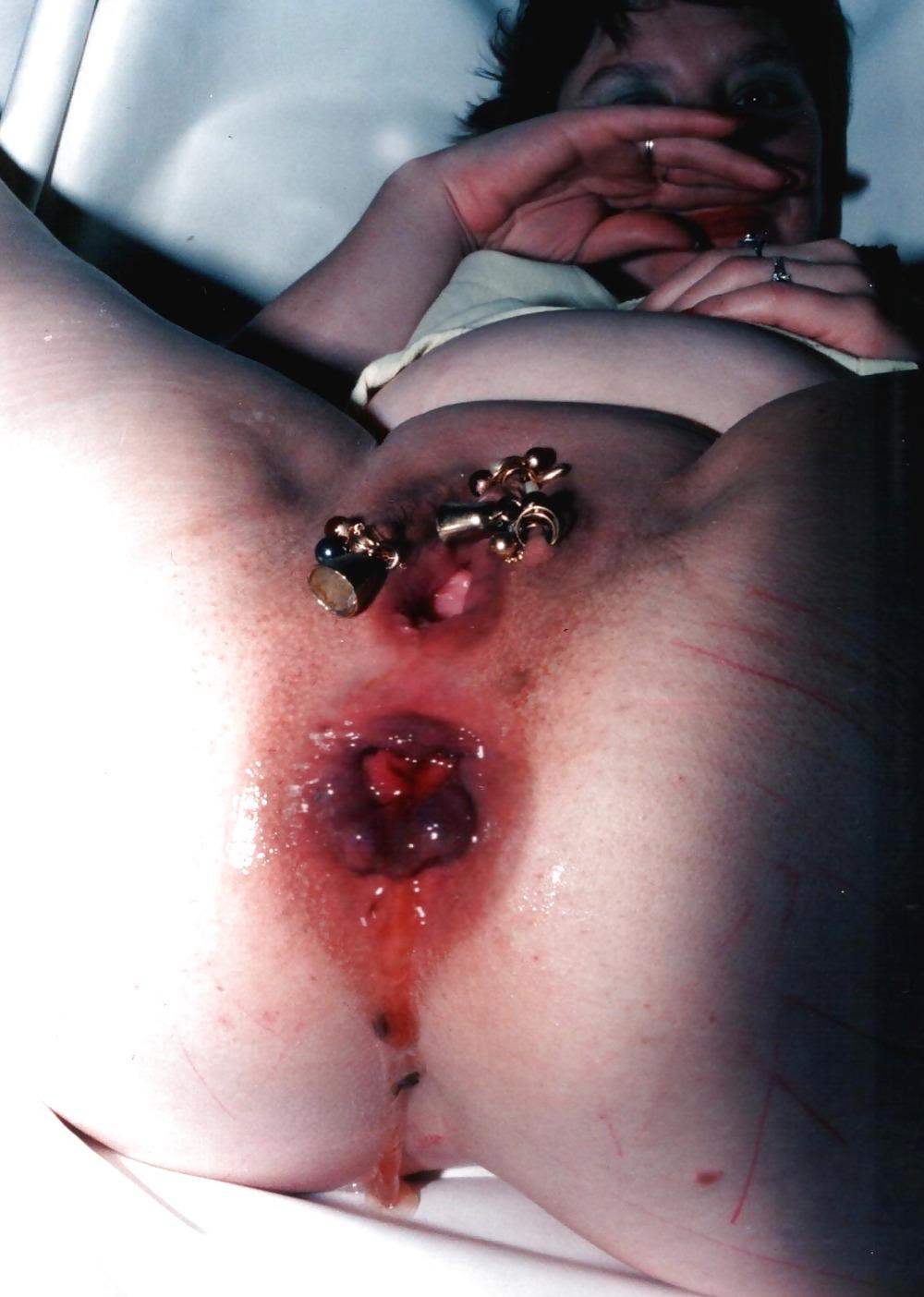 14P ANUS DESTROY