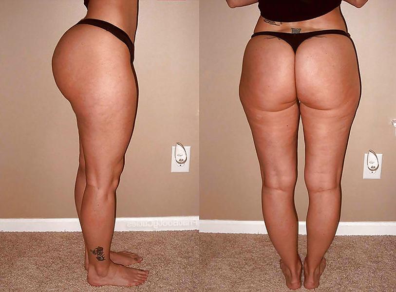 25P Thick, White, and Cellulite 44 