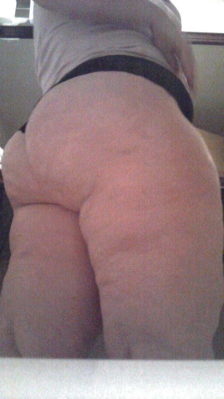 25P Thick, White, and Cellulite 61