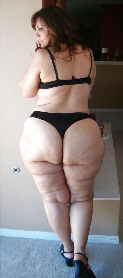 25P Thick, White and Cellulite 85