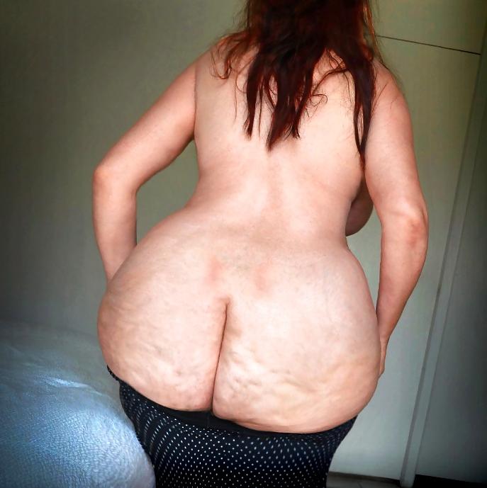 25P Thick, White and Cellulite 108