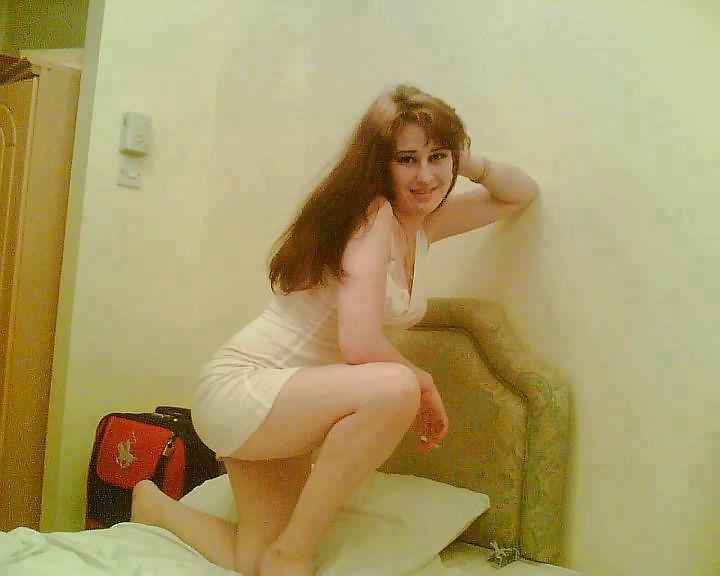 15P Arabian hared body