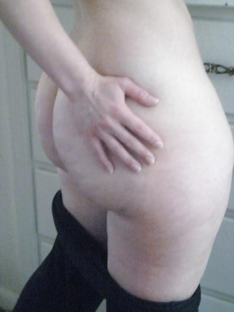 25P Thick, White and Cellulite 114