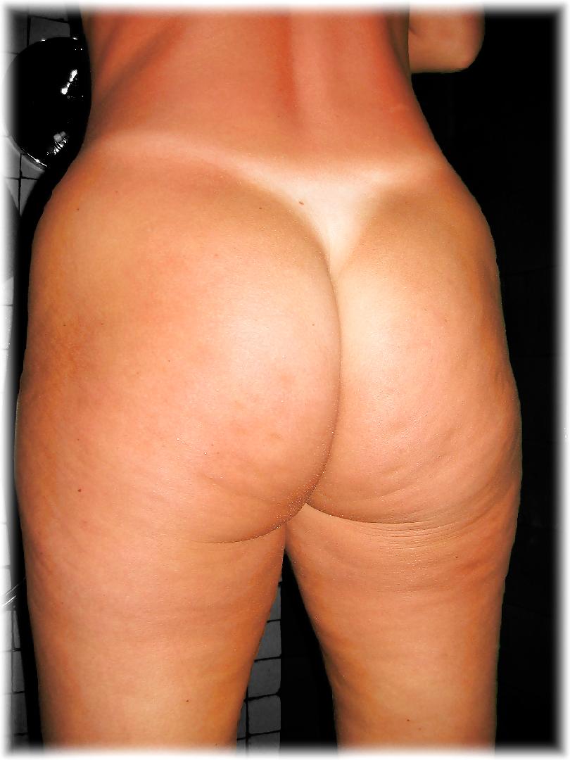 25P Thick, White and Cellulite 114