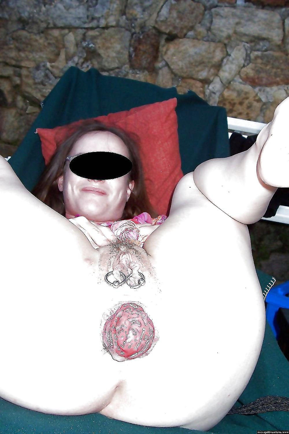 25P Prolapse fun!