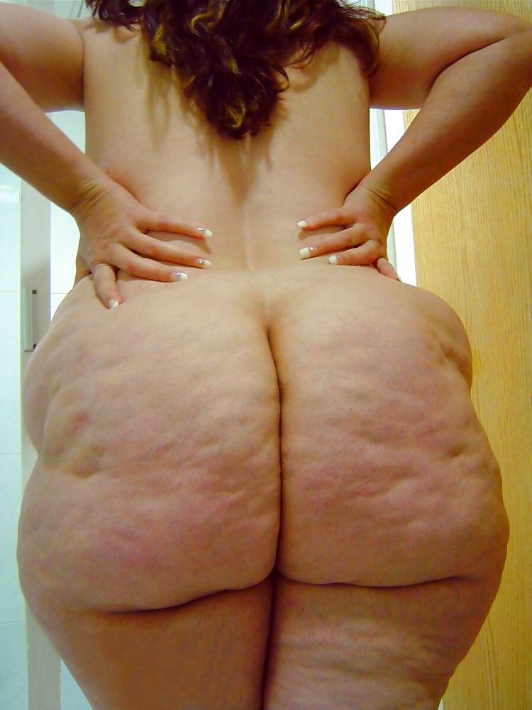 25P Thick, White and Cellulite 98
