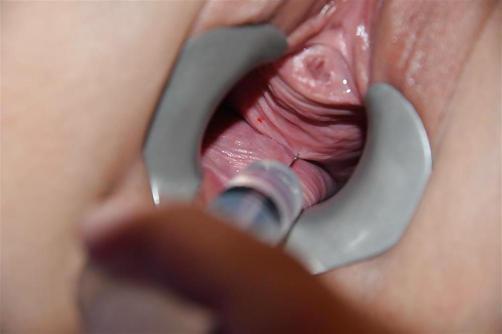 11P New Piercing and white play