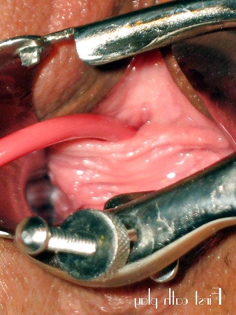 25P Catheter play and insertions