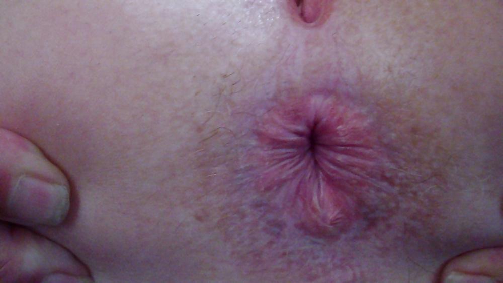 10P Mature pussy & Anus close ups
