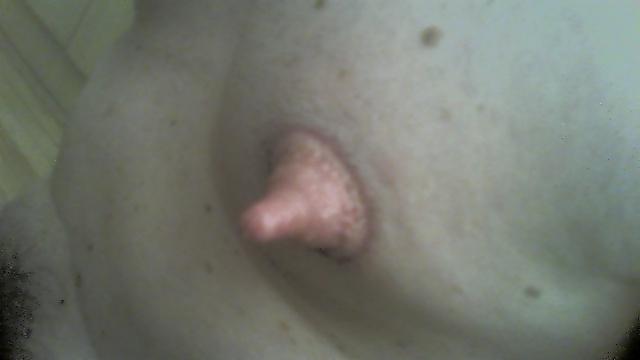 10P Hot tities after teat shaped pumping