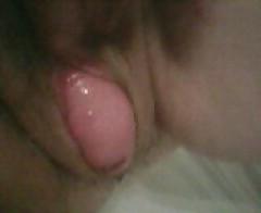 6P Big prolapse
