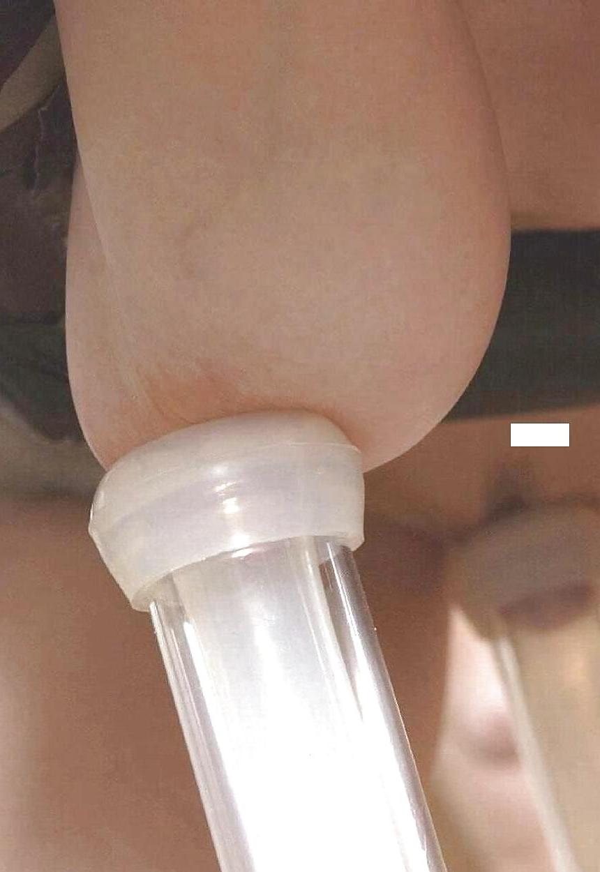17P Milking