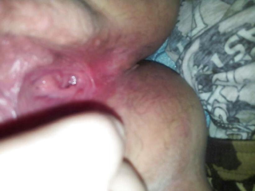 6P Fat girl and her ugly pussy 