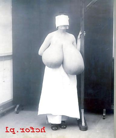 25P Saggy Tits 33 (by Rodi)