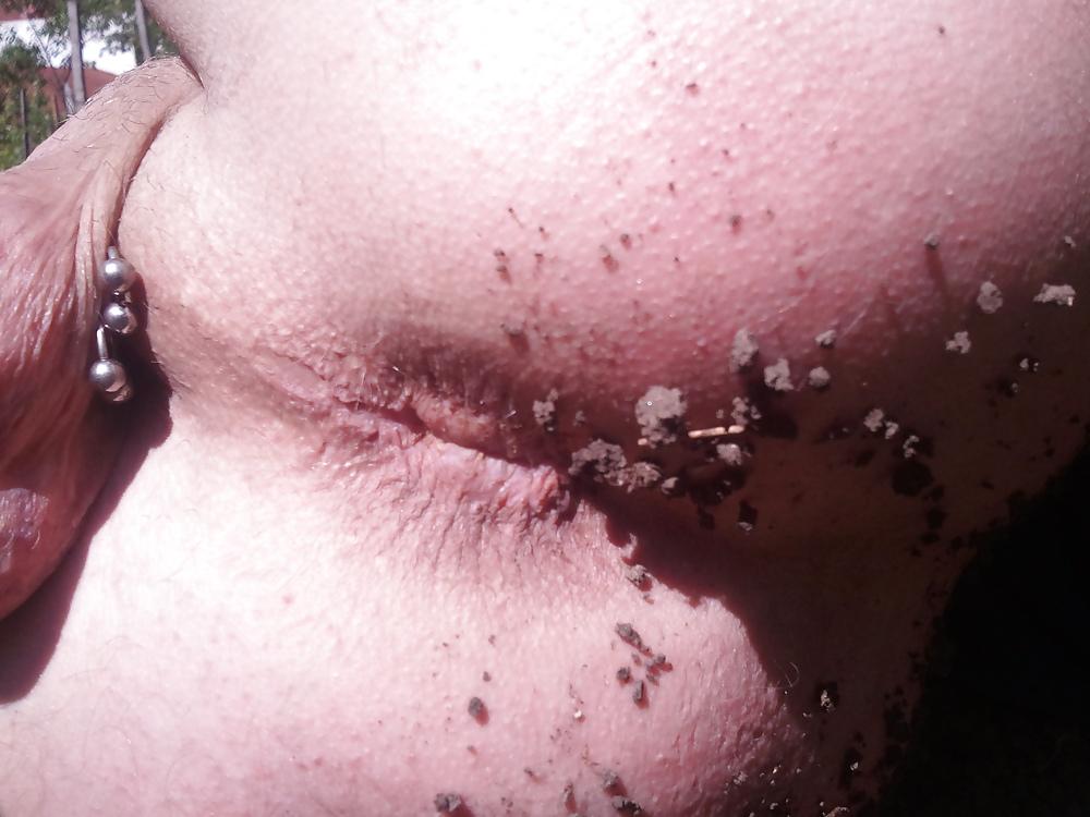 12P My ass and anus outdoors.
