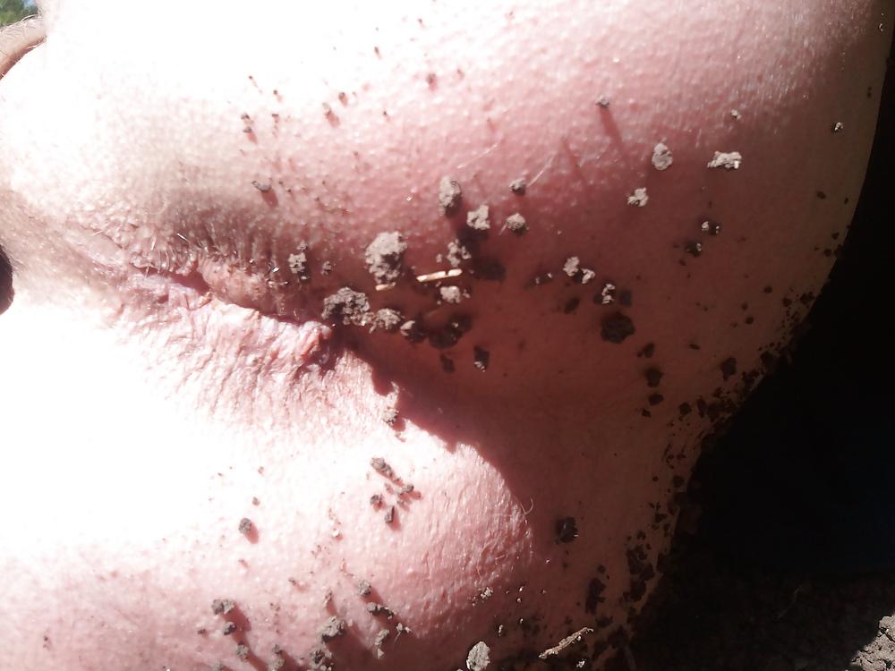 12P My ass and anus outdoors.