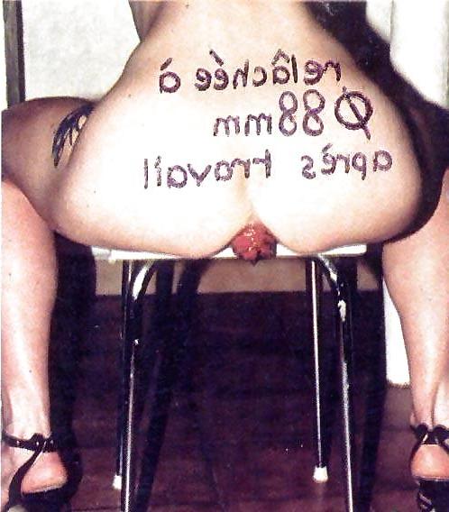 5P Prolapse... I'M LOVIN IT!!!