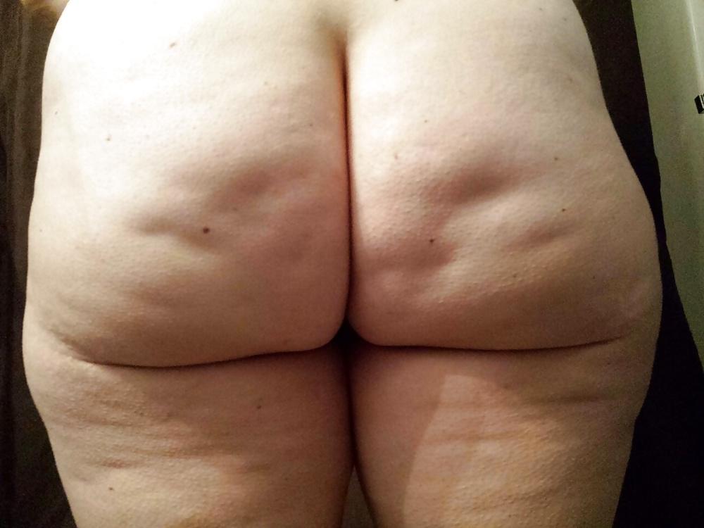 25P Thick, White and Cellulite 121