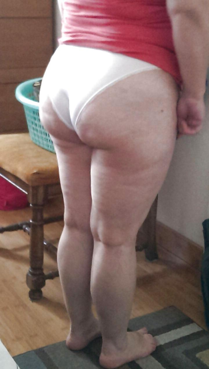25P Thick, White and Cellulite 121