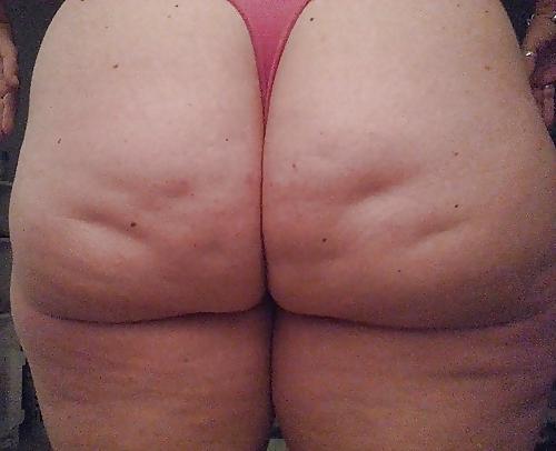 25P Thick, White and Cellulite 121
