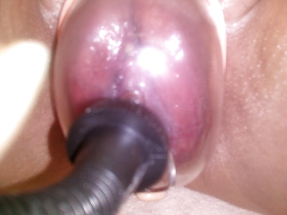 14P Pumping