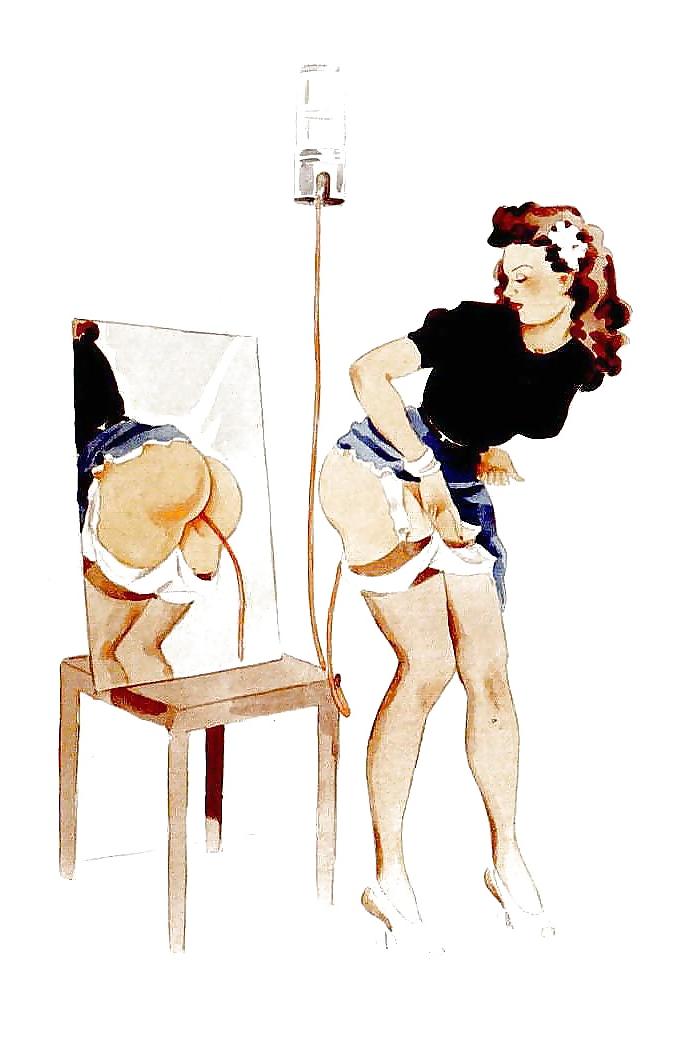 25P Feminization Art by German