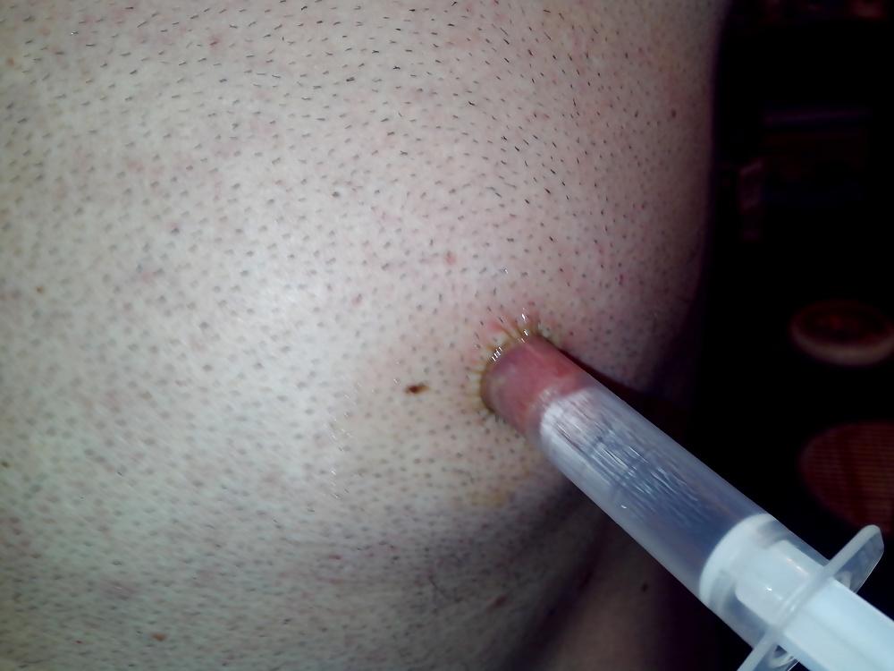 15P Amateur bisexual 2