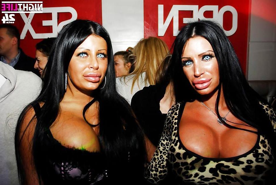25P Las Bimbo chichonas