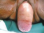 6P Prolapse in elderly ladies is lickable and suckable part 5