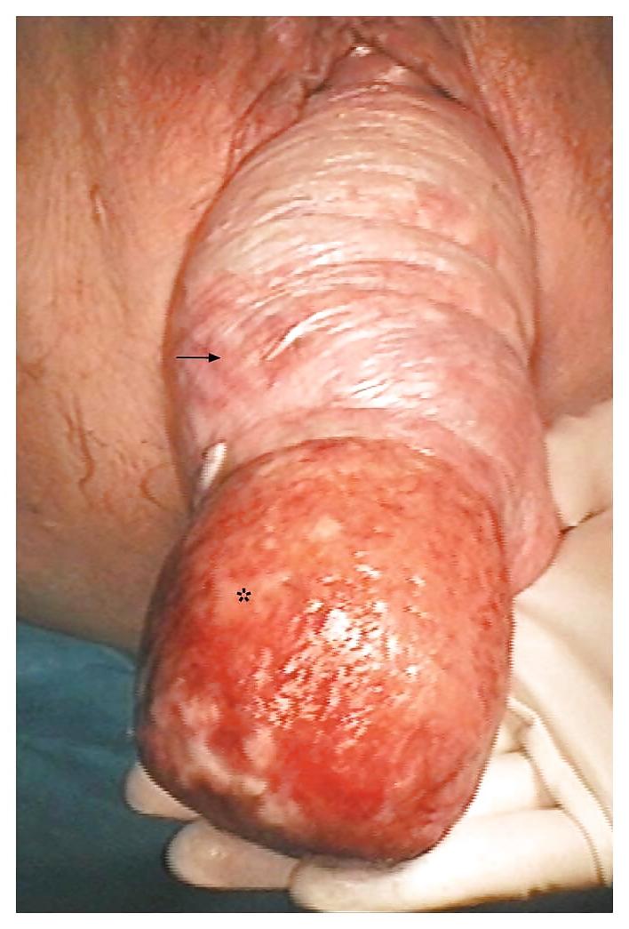 6P Prolapse in elderly ladies is lickable and suckable part 5