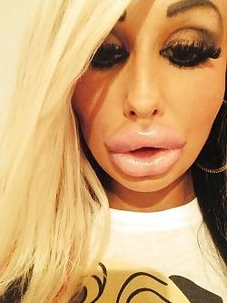 25P Bimbo Slut Lips