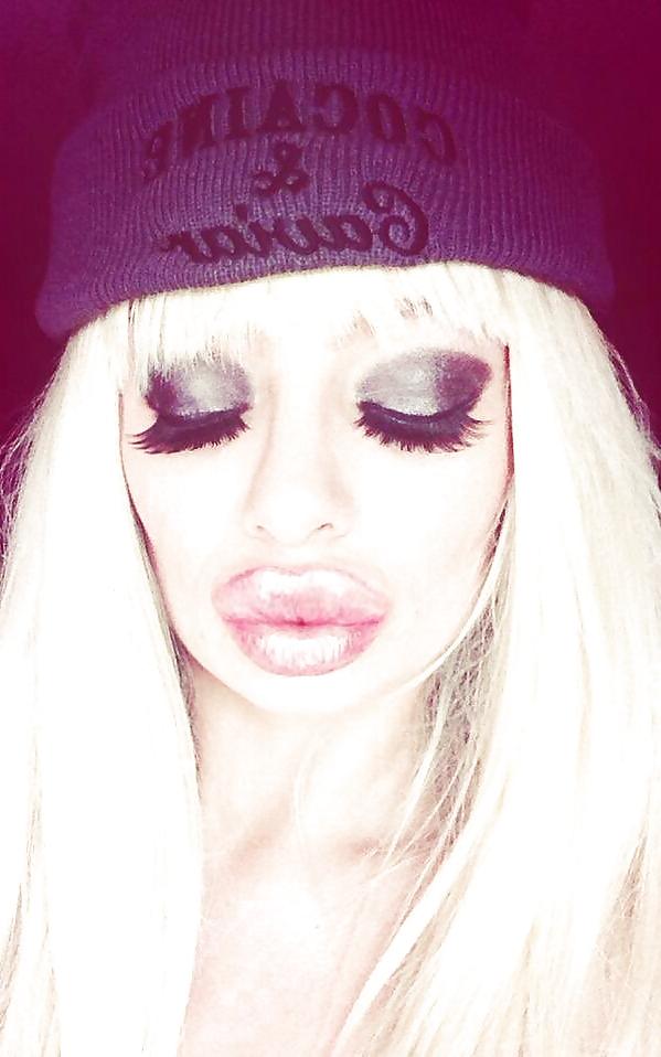 25P Bimbo Slut Lips