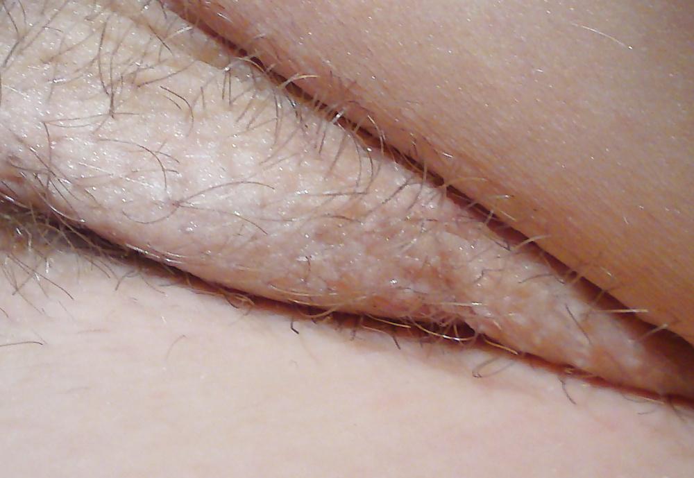 25P Horny armpit