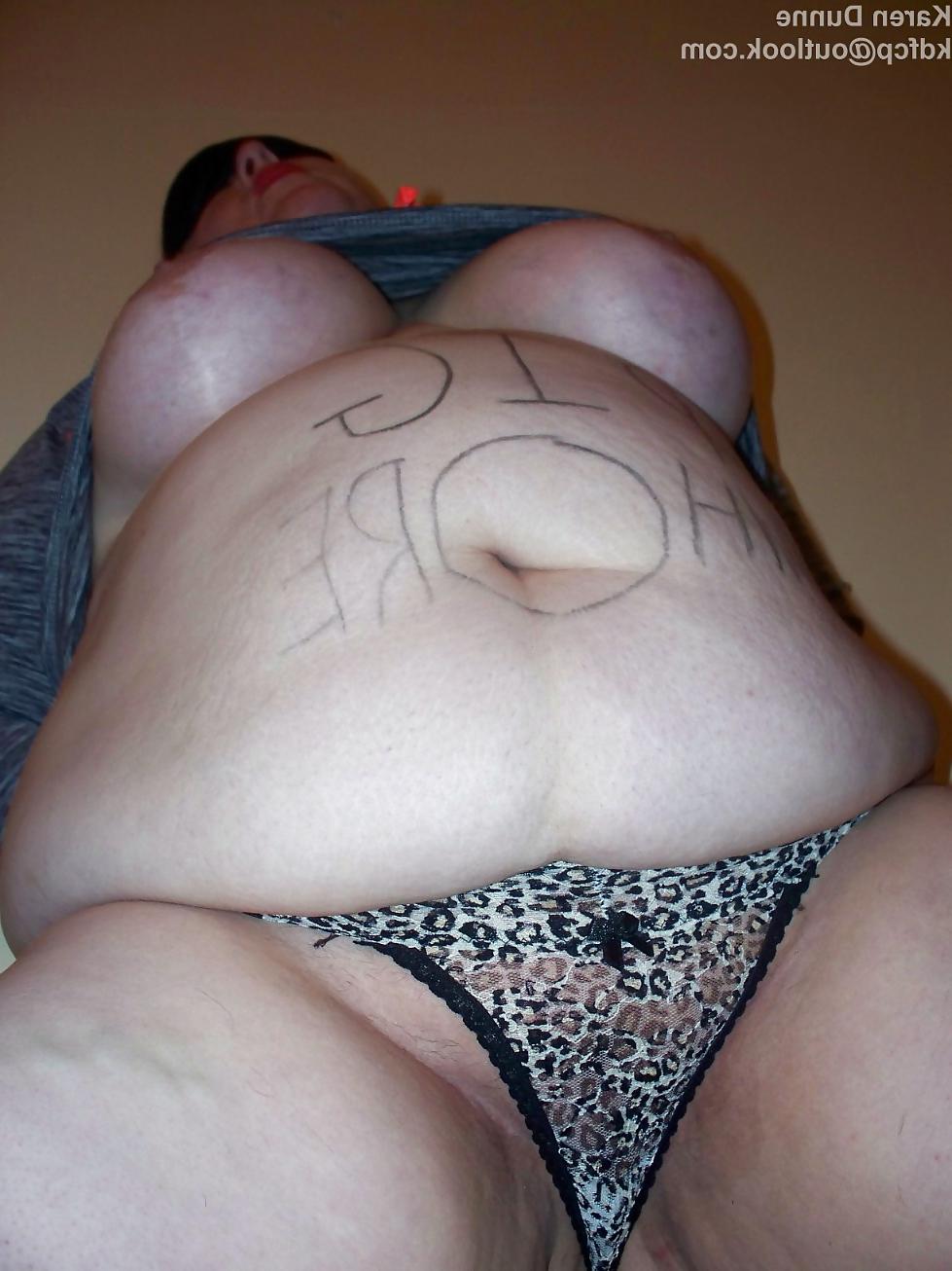 25P Fat Chav Karen Dunne Exposed