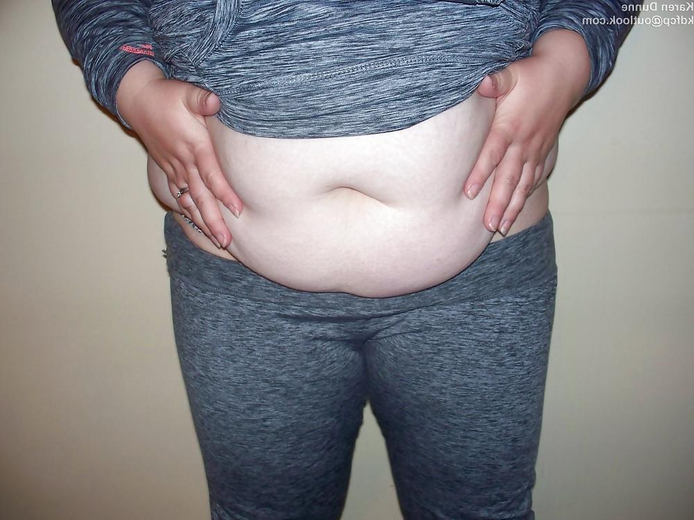 25P Fat Chav Karen Dunne Exposed
