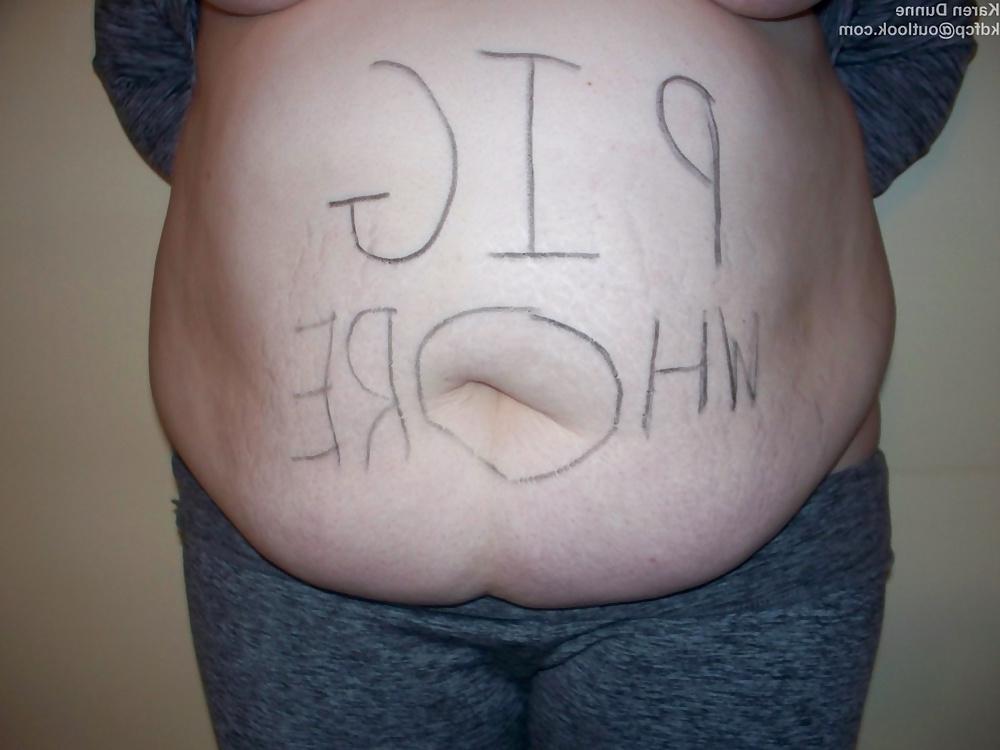 25P Fat Chav Karen Dunne Exposed