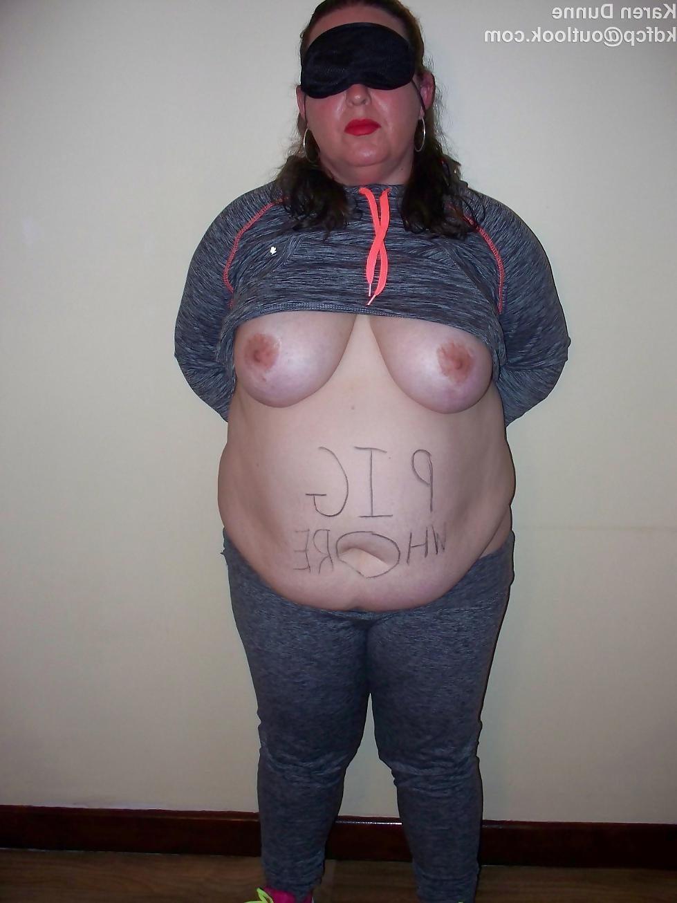 25P Fat Chav Karen Dunne Exposed
