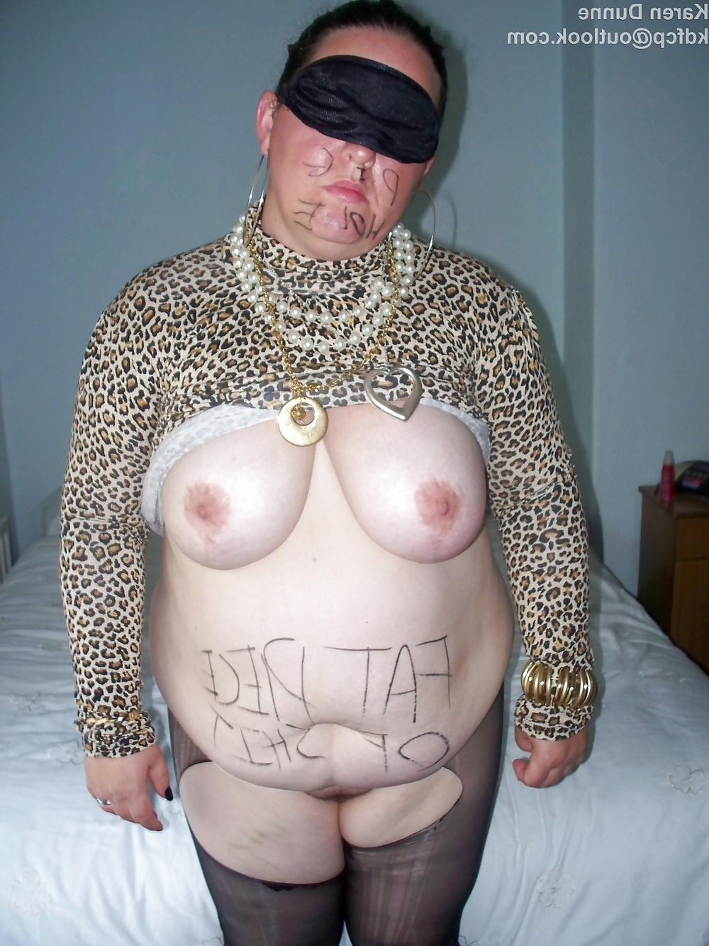14P Fat Chav Slut Karen Dunne Exposed