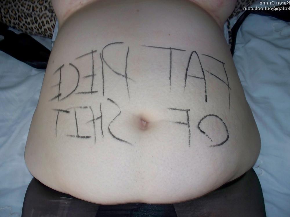 14P Fat Chav Slut Karen Dunne Exposed