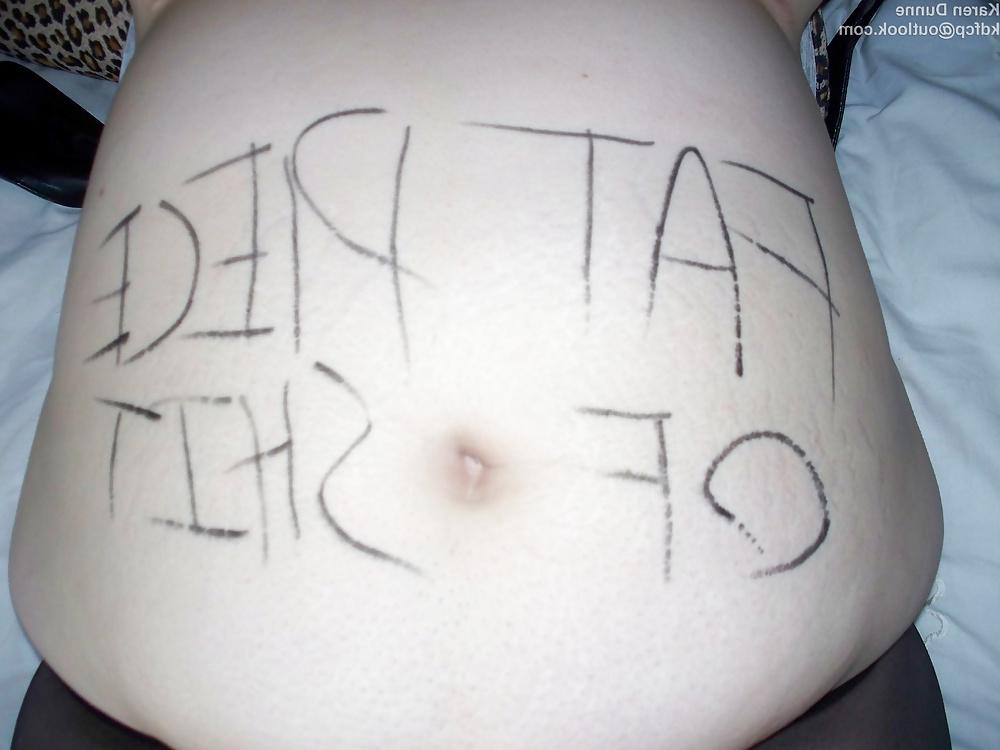 14P Fat Chav Slut Karen Dunne Exposed