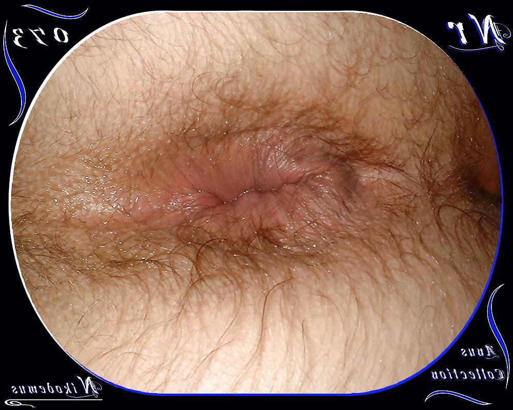 25P Anus Collection