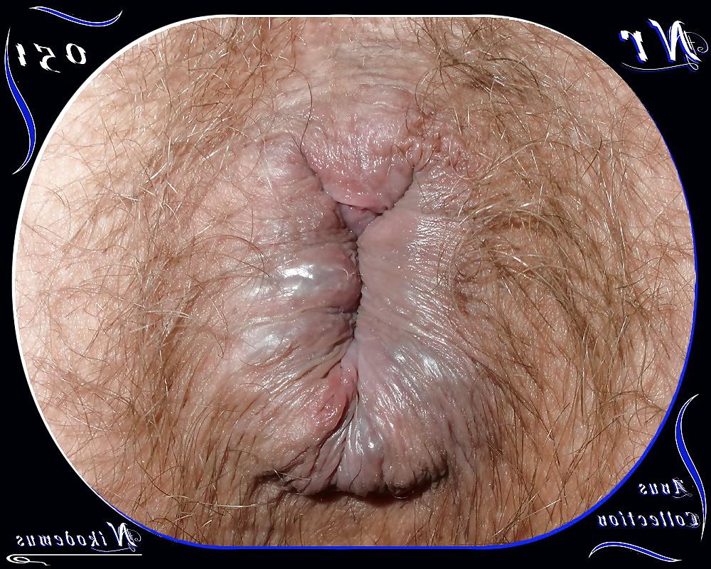 25P Anus Collection