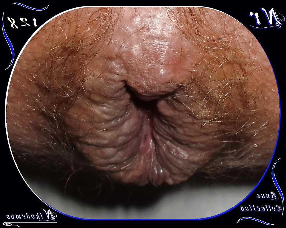 25P Anus Collection