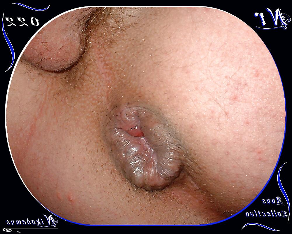 25P Anus Collection