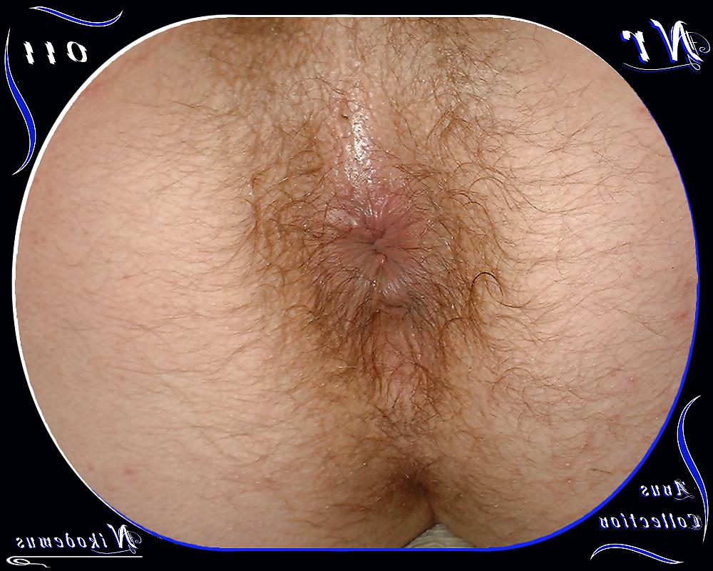 25P Anus Collection