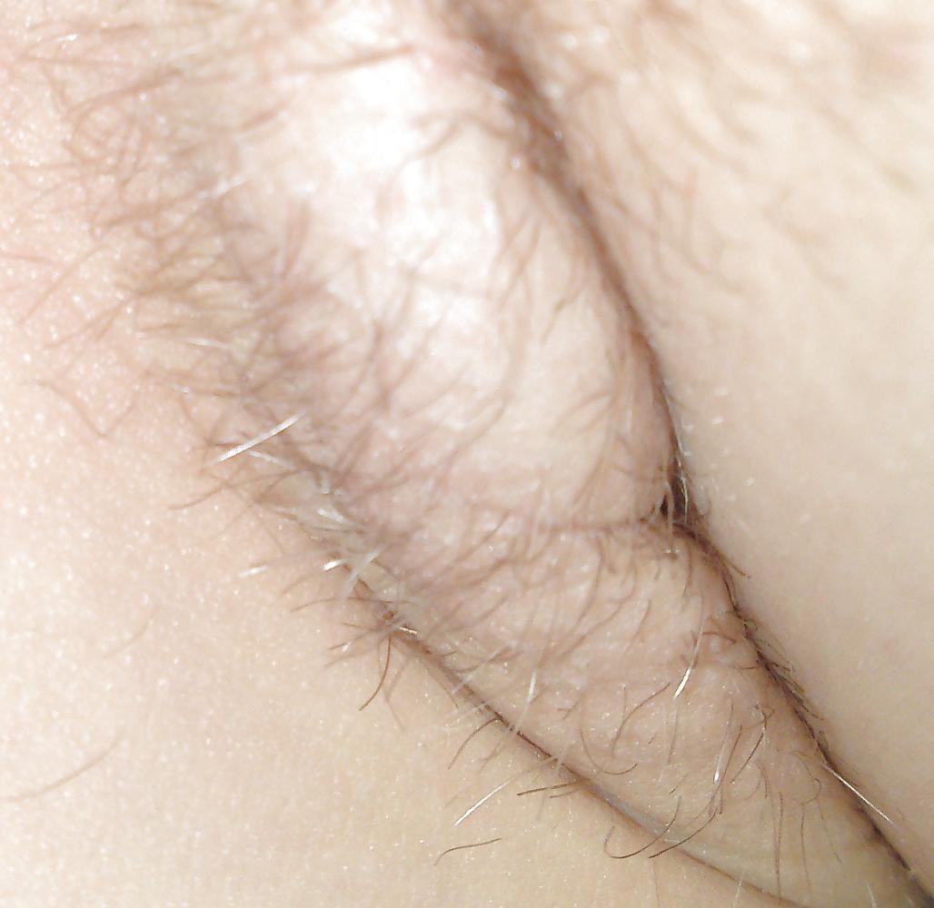 25P HD Armpit