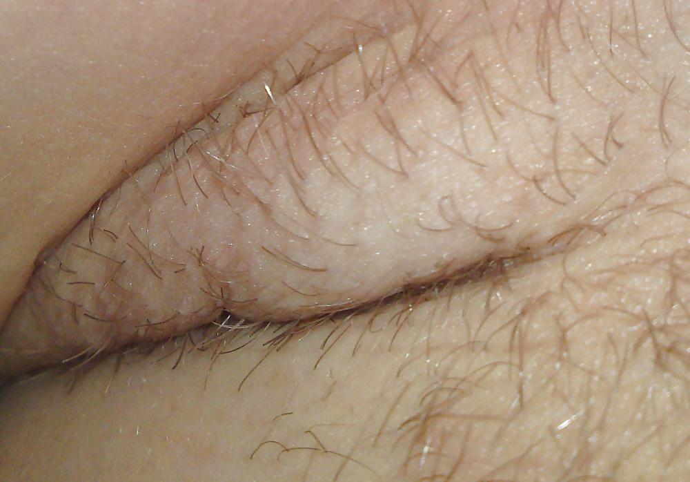 25P HD Armpit